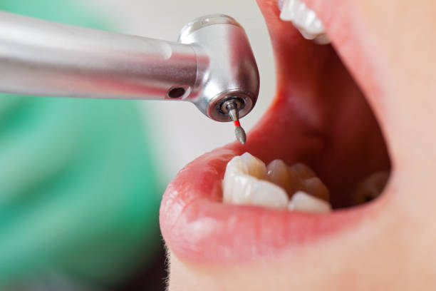 Best Walk-In Emergency Dentist in Evadale, TX